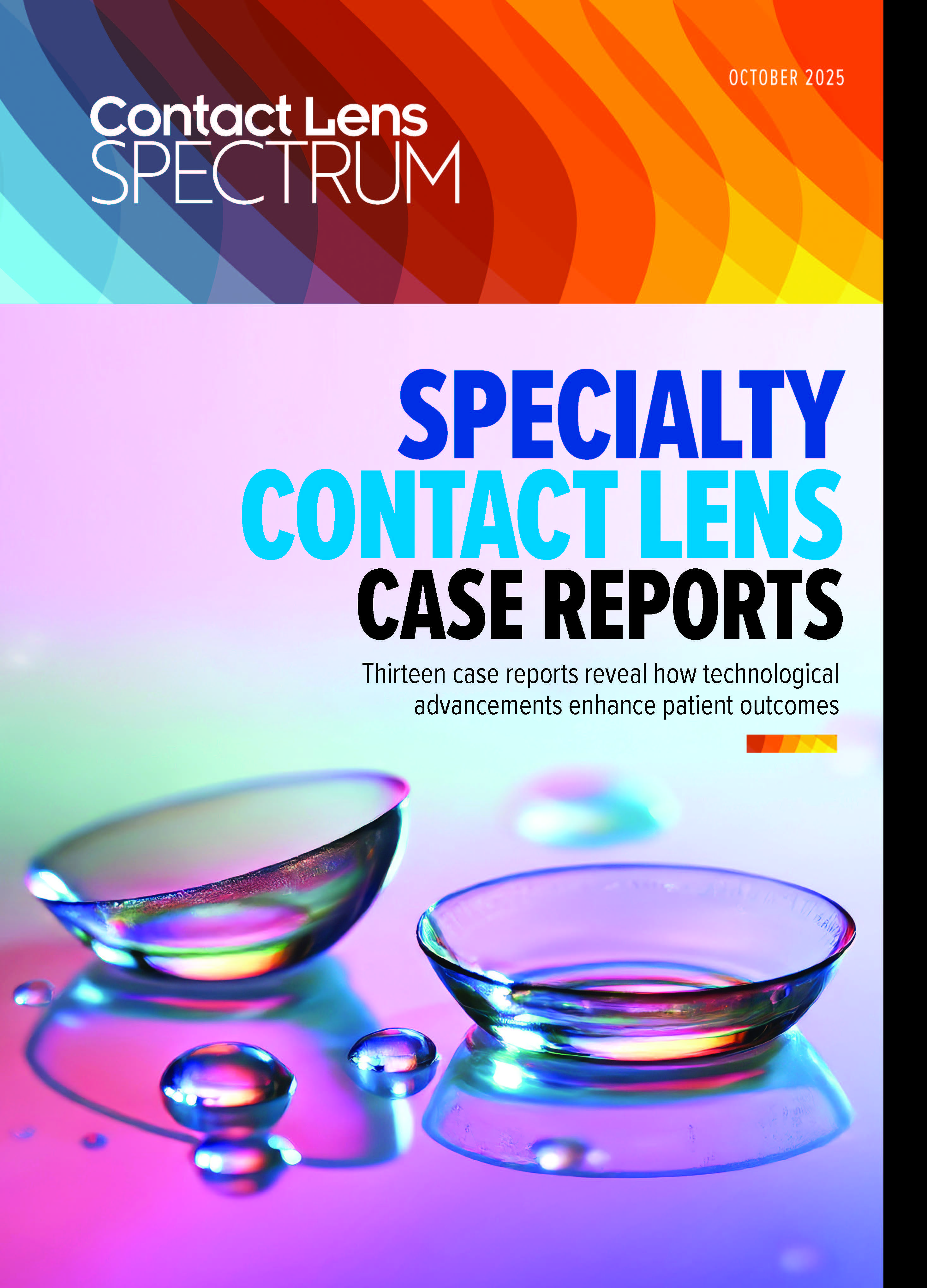 Contact Lens Spectrum